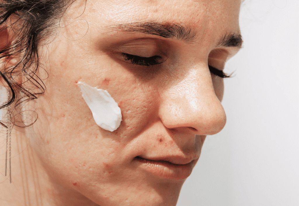 Stress de la rentrée comment préserver l’équilibre de sa peau ?